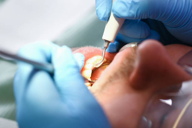 Best Urgent Tooth Repair  in St Leon, IN